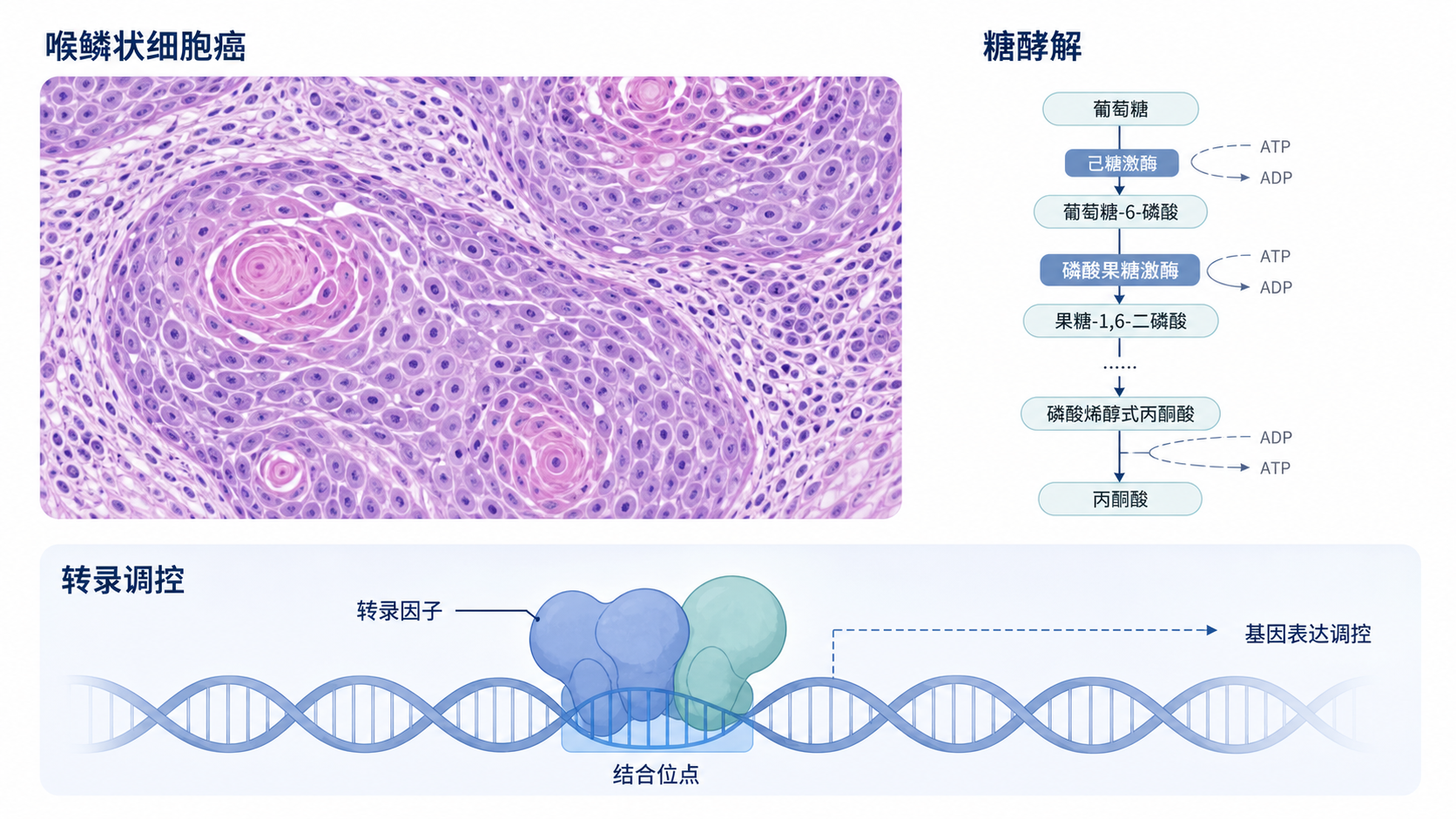 喉鳞状细胞癌病理切片、糖酵解通路示意图、转录因子结合DNA的科研插画，整体风格专业简洁