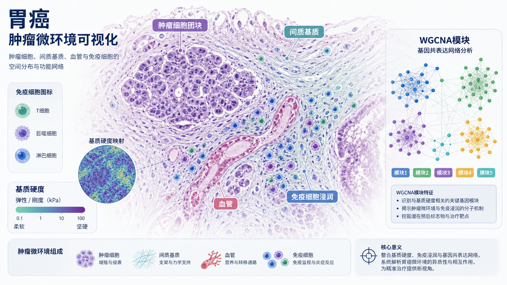 胃癌组织切片与肿瘤微环境示意图，叠加基质硬度、免疫细胞浸润和WGCNA网络模块图标