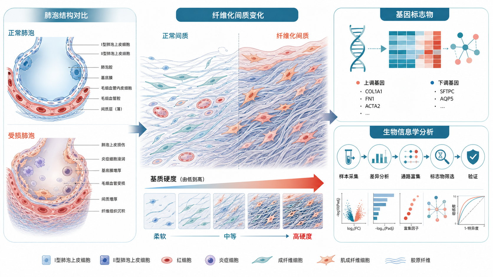 肺泡结构与纤维化间质示意图，叠加基质硬度、基因标志物和生物信息学分析流程图。