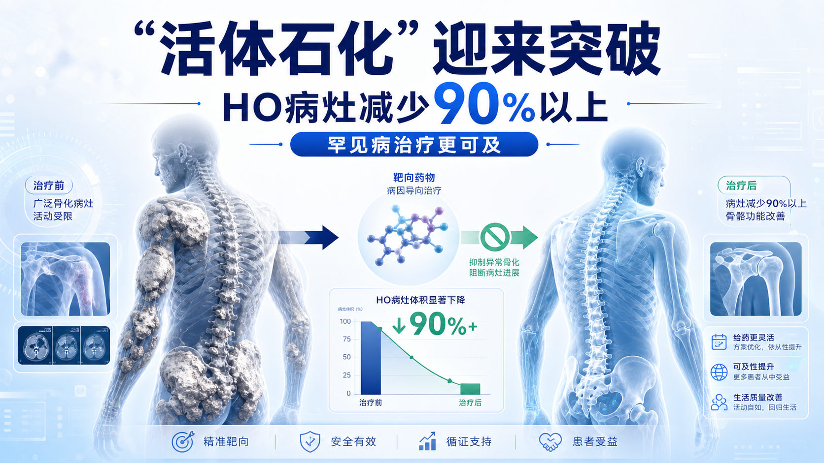 每日资讯速递2026-08-19-FDA批准首款FOP治疗药Pasatru