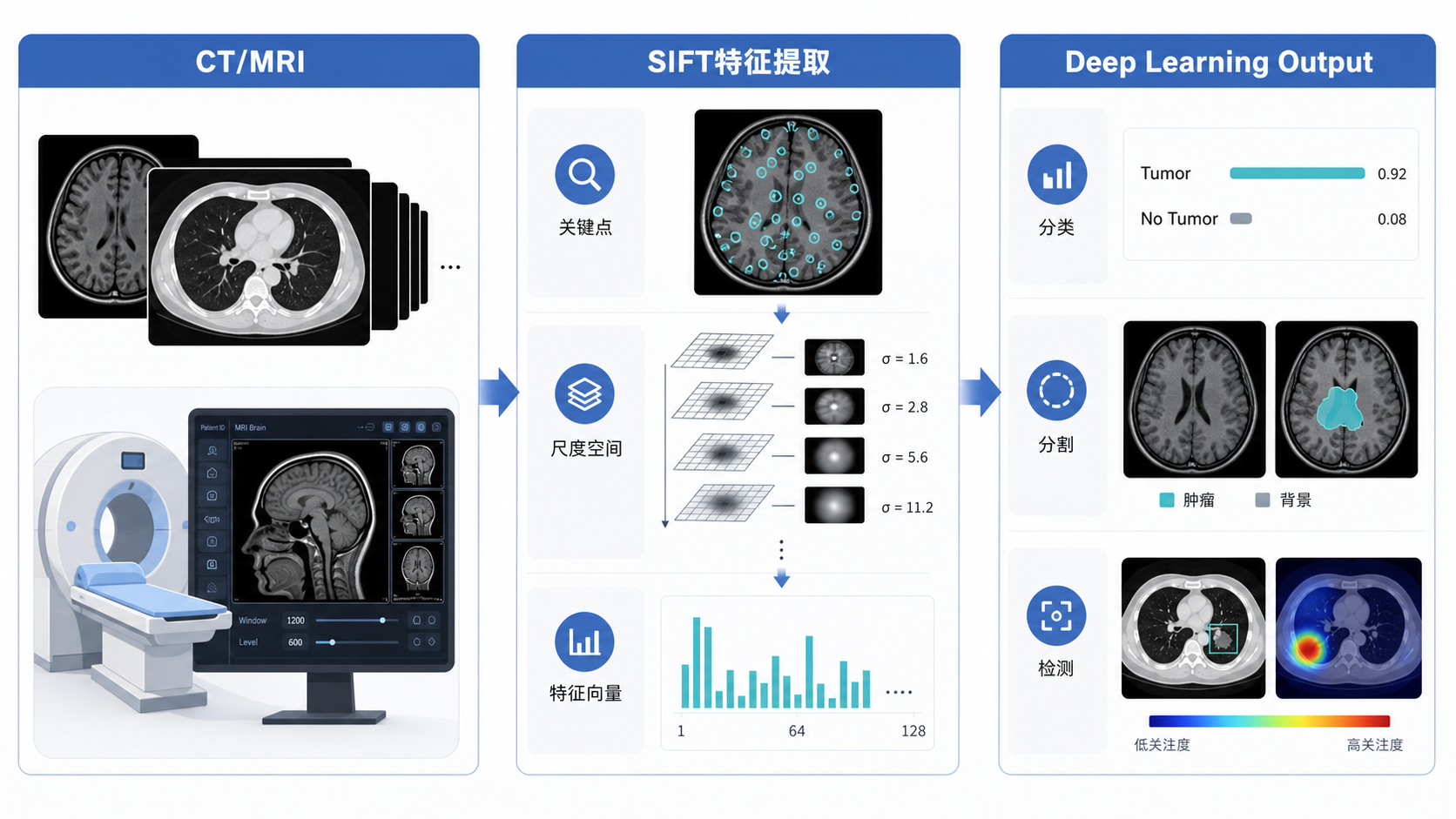 医学影像工作流示意图,左侧为CT/MRI原始图像,中间为SIFT特征提取,右侧为深度学习模型输出诊断结果