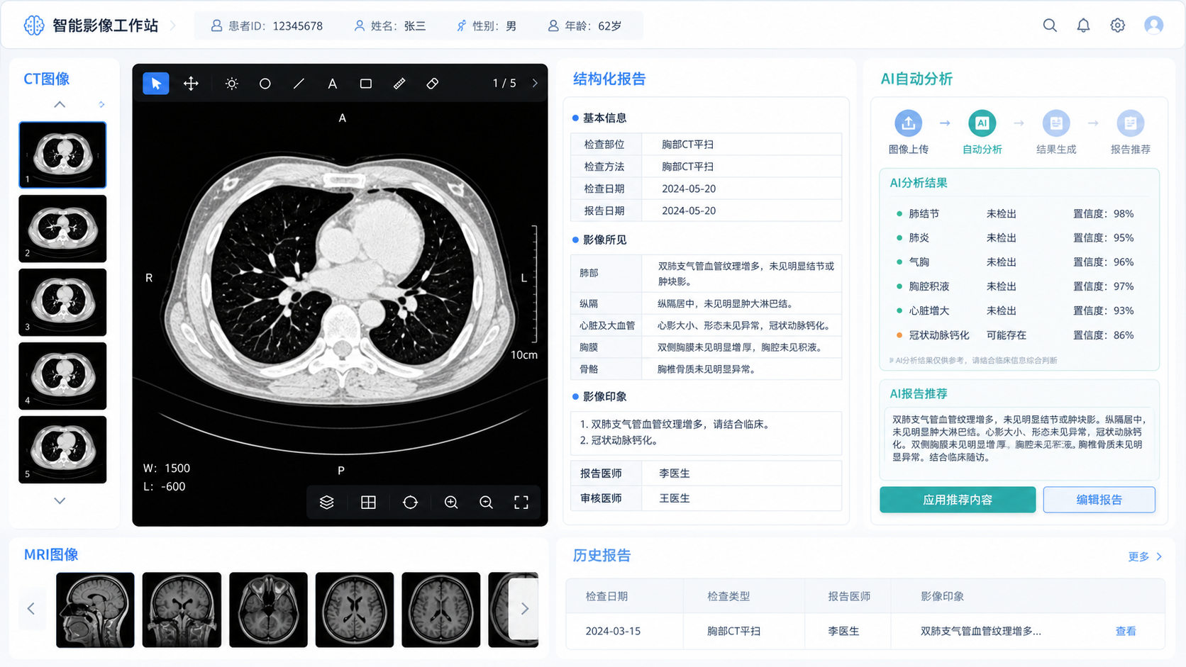 医学影像工作场景,左侧为CT或MRI图像,右侧为结构化影像报告与AI自动化流程界面,整体风格专业简洁
