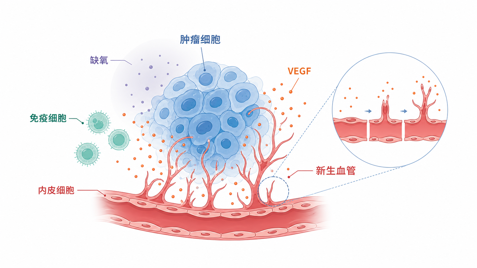 肿瘤微环境示意图,中心为肿瘤细胞,周围标注内皮细胞、VEGF、缺氧、免疫细胞和新生血管,突出血管生成信号通路的动态调控
