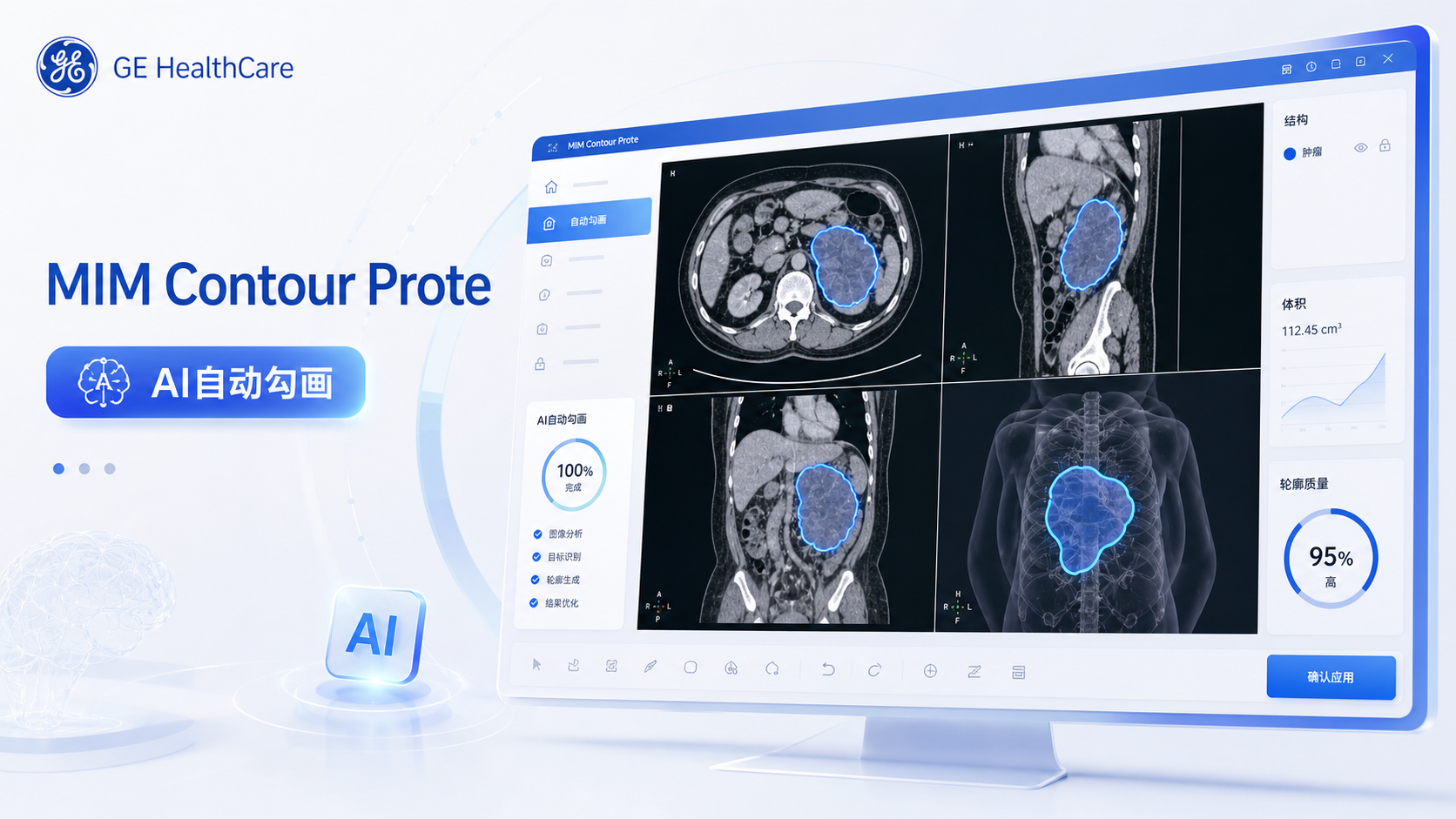 GE HealthCare 近日宣布，其 AI 自动勾画软件 MIM Contour ProtegeAI+ 2.0 已获美国 FDA 510(k) 批准，用于放射治疗计划中的靶区与危及器官自动勾画。新版本新增磁共振（MR）脑部模型，并更新了 CT 男性盆腔模型，进一步拓展了适用解剖部位；同时，该批准还包含「预定变更控制计划」（PCCP），使未来 AI 模型的更新与扩展能够沿既定监管路径更高效地推进。