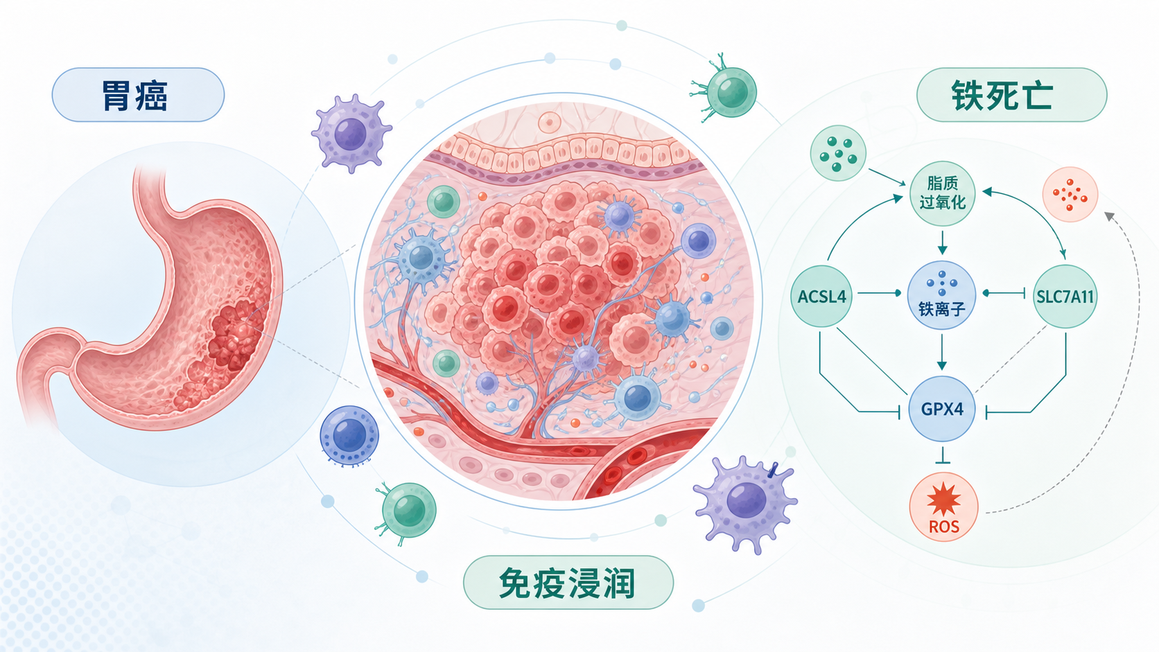 胃癌组织、铁死亡相关分子网络、免疫细胞浸润示意图组合的科研风格封面图