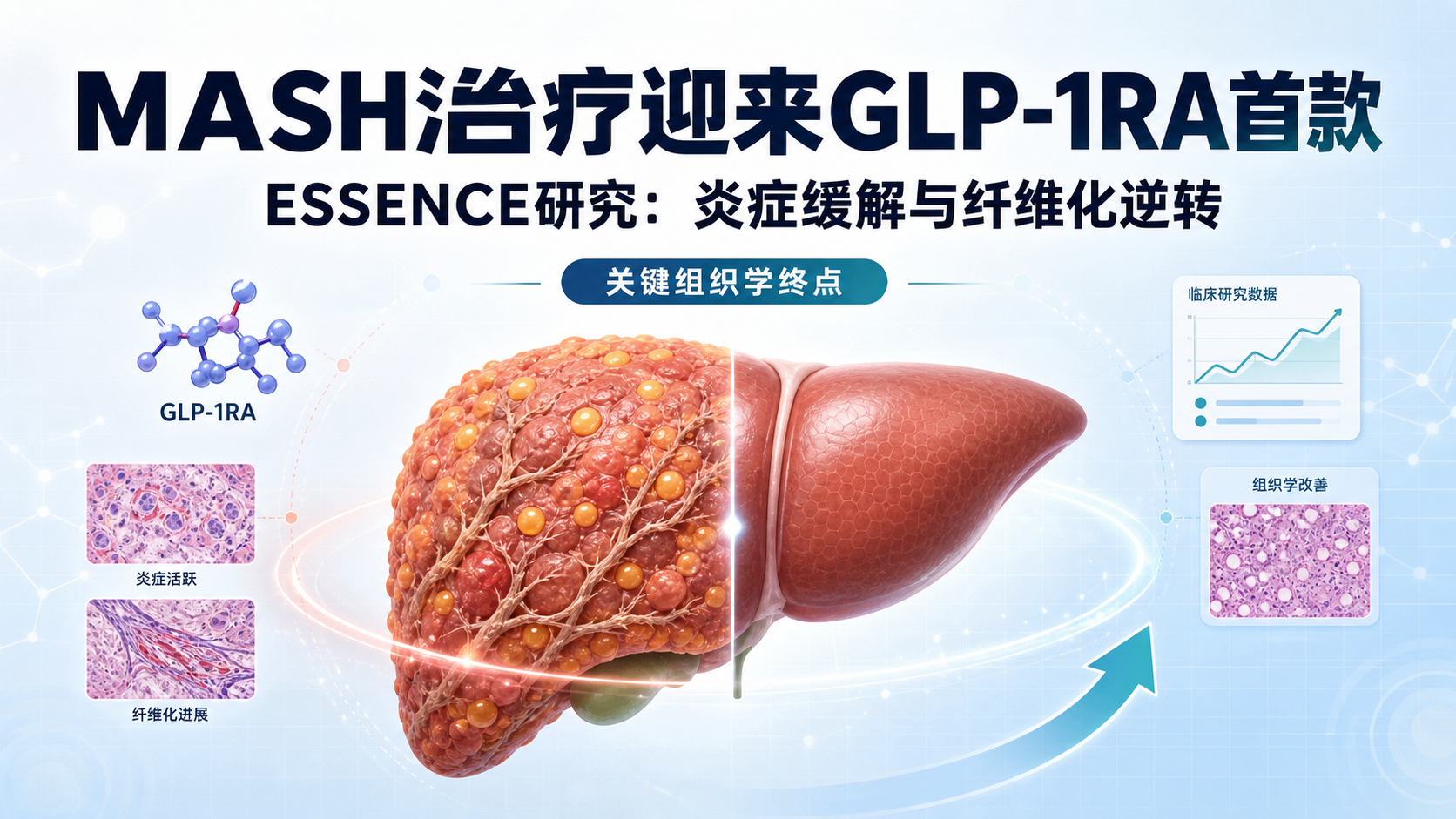 司美格鲁肽MASH适应症获NMPA批准成为首个GLP-1RA
