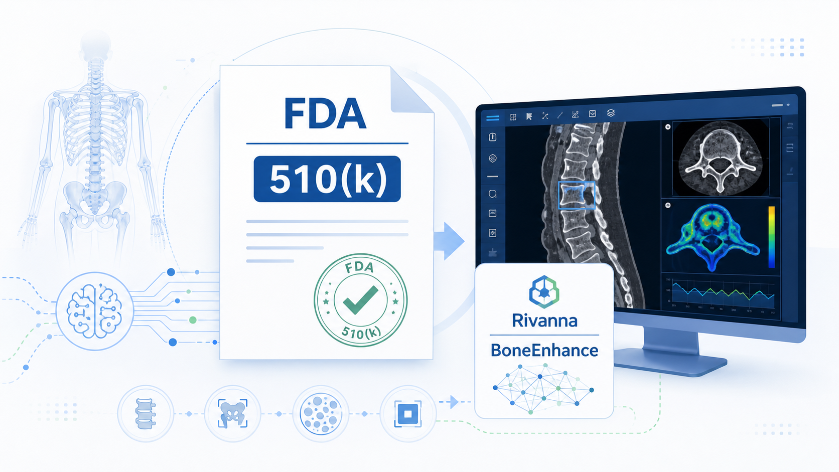 美国 FDA 授予 Rivanna 公司 BoneEnhance 机器学习模块 510(k) 许可。该模块用于其 Accuro XV 肌骨超声系统，可对骨骼及周围组织进行自动化分割，并以彩色叠加增强三维可视化。独立测试显示，该模块基于 173 名患者、69,900 张图像，逐体积标签预测准确率达 95.1%–100%，为肌骨超声的自动化体积采集与 AI 辅助阅片奠定了基础。