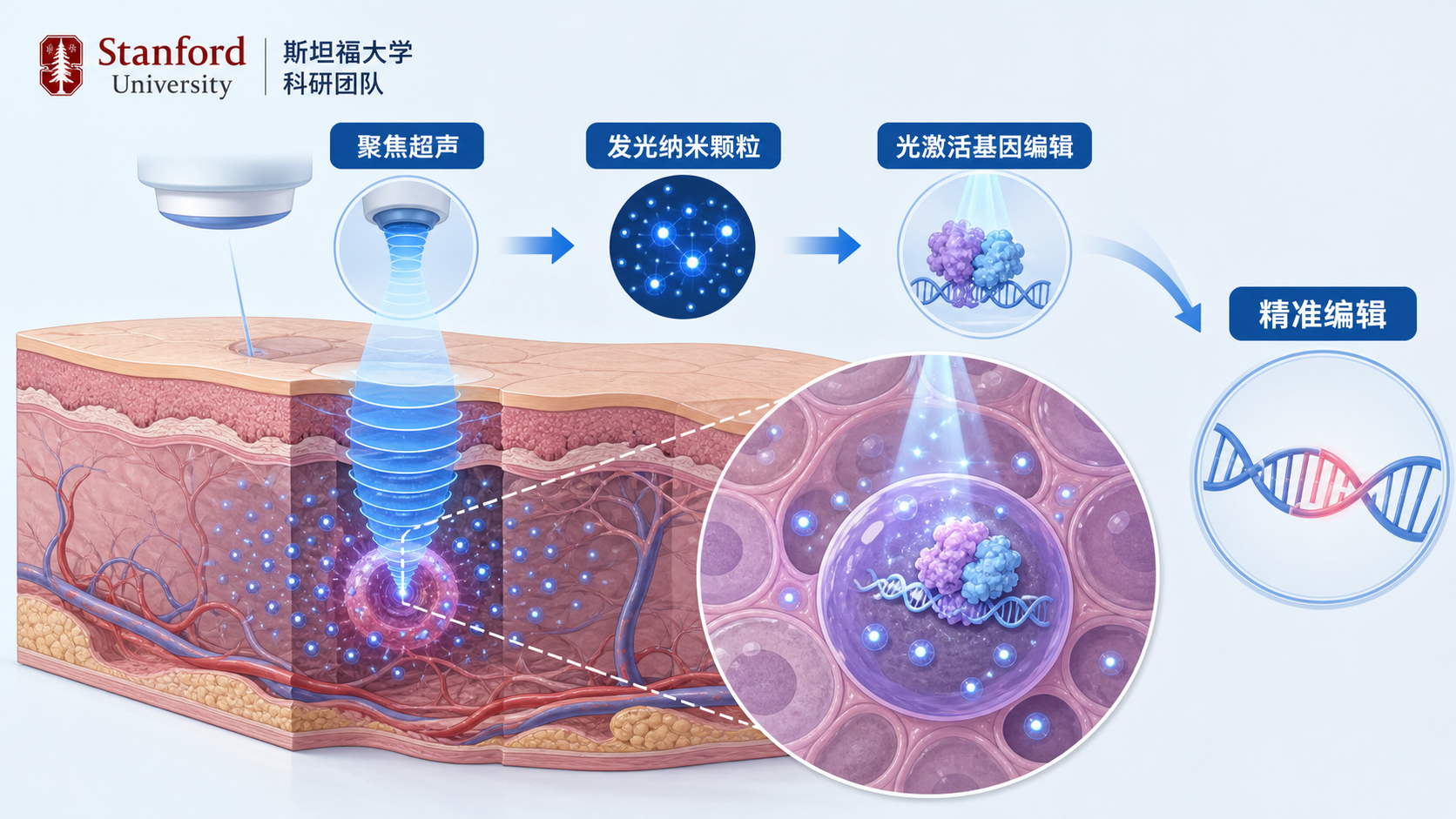 斯坦福大学团队在《细胞》发表的一项研究中,将聚焦超声、发光纳米颗粒与可被光激活的基因编辑蛋白结合,首次在小鼠大脑等深部组织的特定位置实现无创、空间精准的基因编辑,为神经系统疾病的精准治疗开辟了新思路。