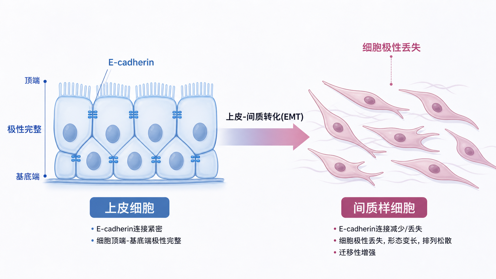 上皮细胞通过E-cadherin连接形成紧密排列的结构,向间质样细胞转化的示意图,标出细胞极性丢失、迁移增强和E-cadherin下调