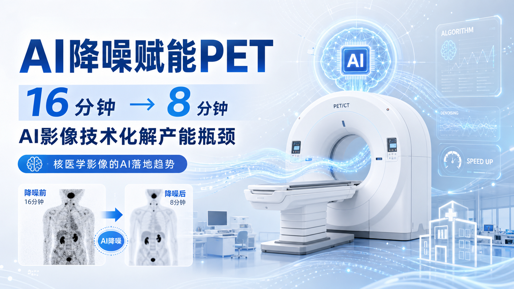 FDA批准新一代AI赋能PET成像软件扫描时间最高缩短75%