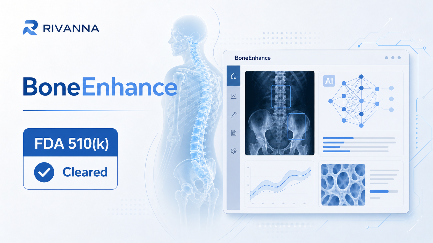 RIVANNA 公司宣布其 BoneEnhance 机器学习软件模块获得美国 FDA 510(k) 批准,作为 Accuro XV 诊断超声系统的首个机器学习模块,可在图像回顾过程中分割骨骼及周围组织,并以三维方式呈现骨骼解剖结构。这一获批标志着该平台从"图像采集"迈向"图像解读",为肌骨超声的点位护理(point-of-care)决策支持奠定基础。
