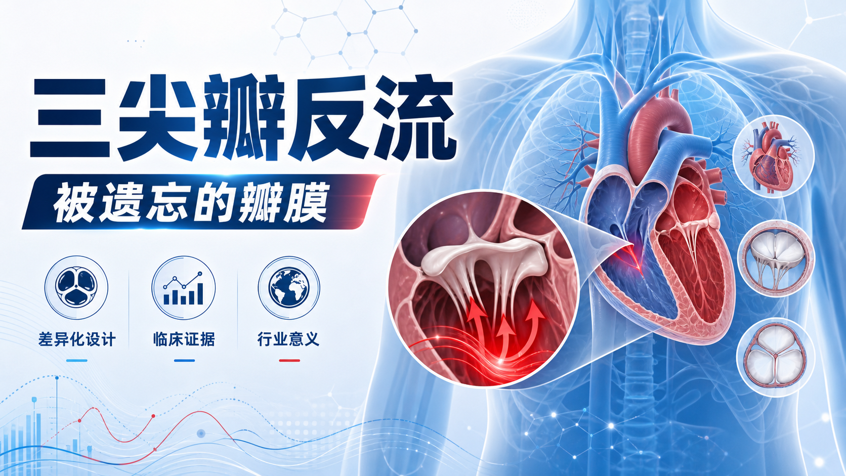 Edwards 三尖瓣修复系统 PASCAL Precision 获 FDA 批准:经导管介入再添新选项